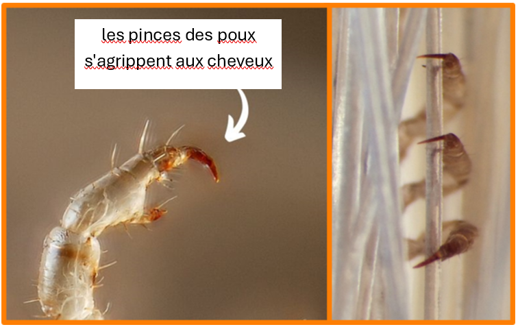 Griffes de poux
